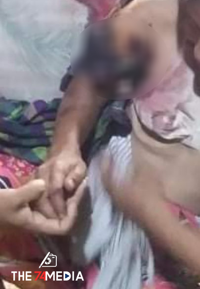 မိုးညှင်းမြို့နယ်တွင် စစ်ကောင်စီ၏ ရမ်းသမ်းပစ်ခတ်မှုကြောင့် ကလေးနှစ်ဦးအပါအဝင် လေးဦးဒဏ်ရာရ